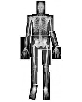 Rentgenové snímky - lidské kostry